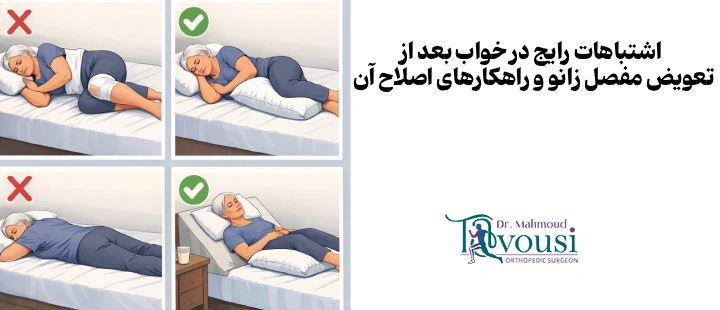 اشتباهات رایج در خواب بعد از تعویض مفصل زانو و راهکارهای اصلاح آن