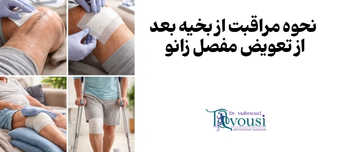 نحوه مراقبت از بخیه بعد از تعویض مفصل زانو