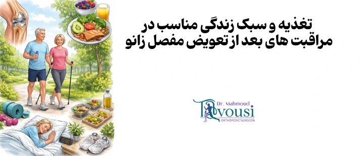 تغذیه و سبک زندگی مناسب در مراقبت های بعد از تعویض مفصل زانو