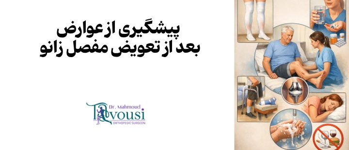 پیشگیری از عوارض بعد از تعویض مفصل زانو