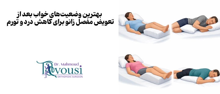 بهترین وضعیتهای خواب بعد از تعویض مفصل زانو برای کاهش درد و تورم