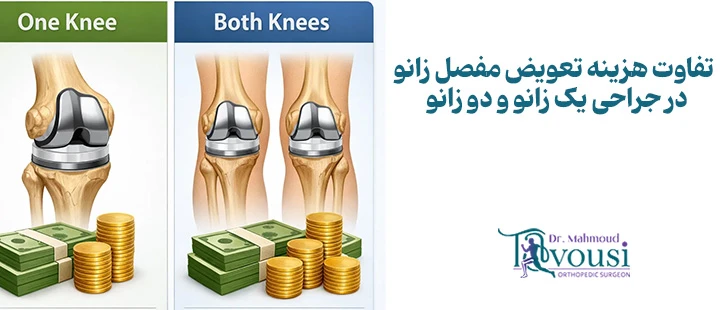تفاوت هزینه تعویض مفصل زانو در جراحی یک زانو و دو زانو