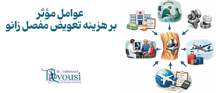 عوامل مؤثر بر هزینه تعویض مفصل زانو