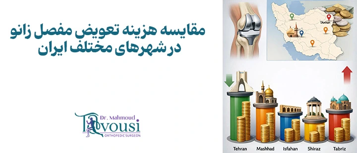 مقایسه هزینه تعویض مفصل زانو در شهرهای مختلف ایران
