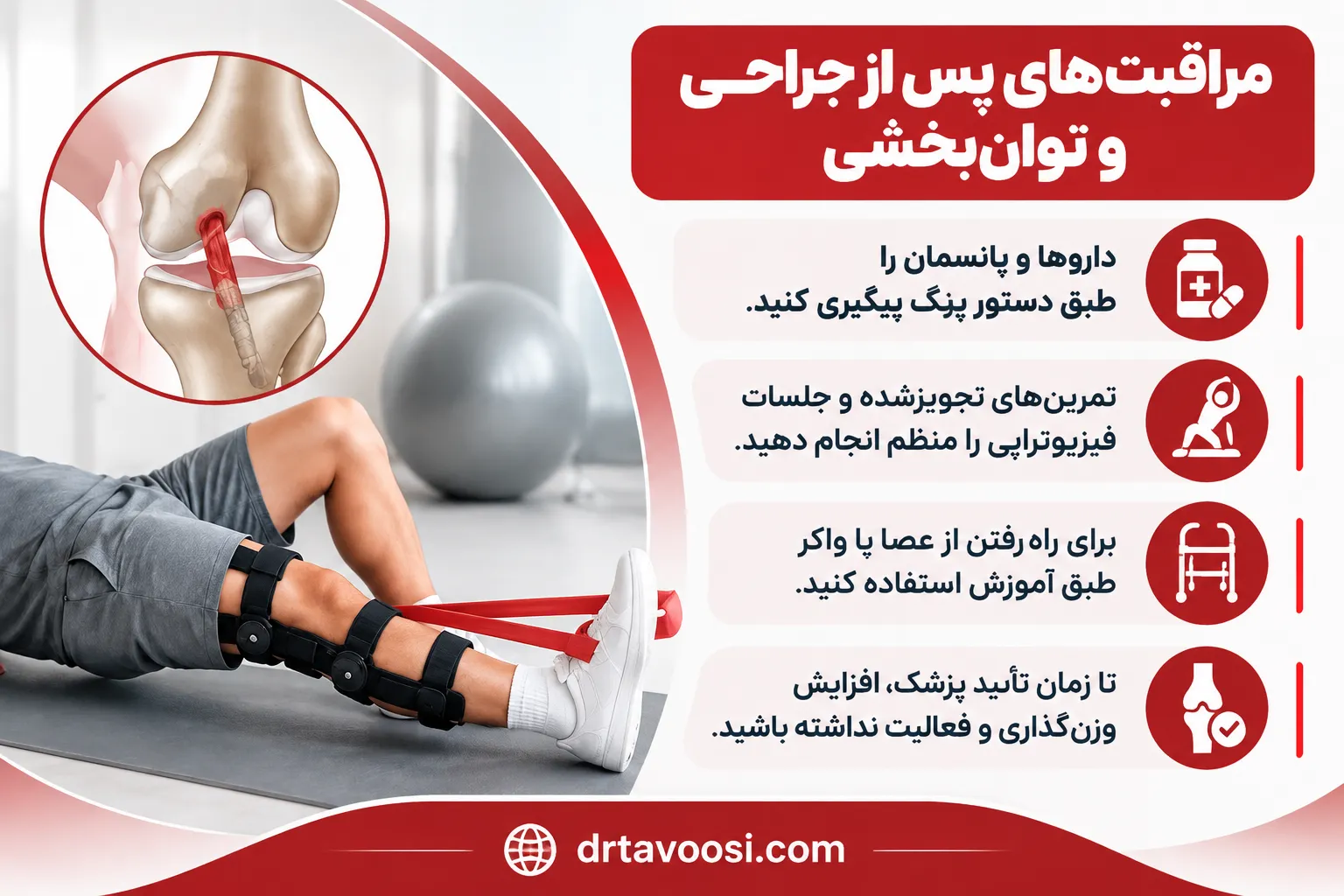مراقبتهای پس از جراحی و توانبخشی — توانبخشی و تمرین درمانی پس از بازسازی رباط صلیبی