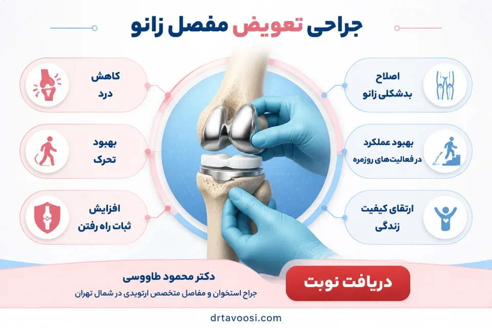 اینفوگرافیک نکات کلیدی و مراحل عمل جایگزینی مفصل زانو